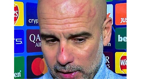 Guardiola come Sangiuliano: graffi sulla testa e in viso. Ma l'allenatore spiega cosa è successo: «Volevo farmi del male» - Il video