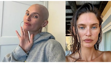 Bianca Balti senza capelli: «Sempre una “bad bitch”». La diagnosi di tumore, l'operazione, la cicatrice e la chemioterapia