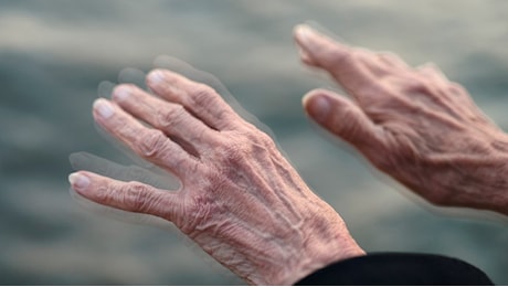 Sarà possibile predire la malattia di Parkinson: lo svela una nuova ricerca