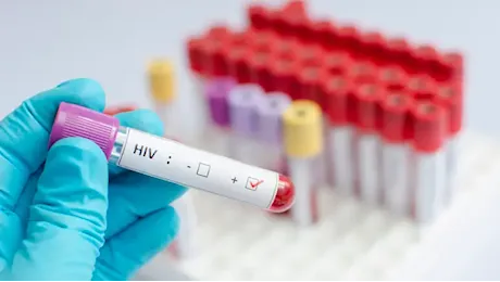 Aids, così le terapie hanno cambiato il destino e la qualità di vita dei pazienti