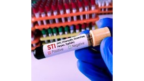 Infezioni sessualmente trasmesse. Aumentano in Italia i contagi da sifilide, gonorrea, clamidia e diminuisce la consapevolezza