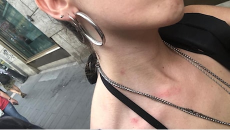 Napoli, aggressione omofoba al Pride: Picchiate da ragazzine, siamo finite in ospedale