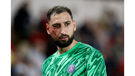 Tremendo scontro con Singo, infortunio shock di Donnarumma in Monaco-Psg: video e foto