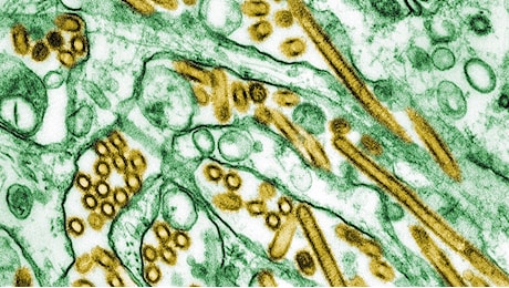 Negli Stati Uniti c'è un primo caso grave di influenza aviaria