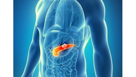 Giornata per il tumore pancreatico: a Modena continua la ricerca